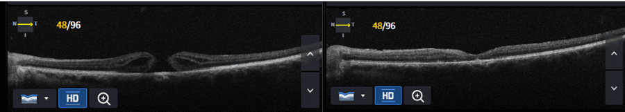 Slider image (10) Dr Nikolaos I Dervenis Eye Clinic